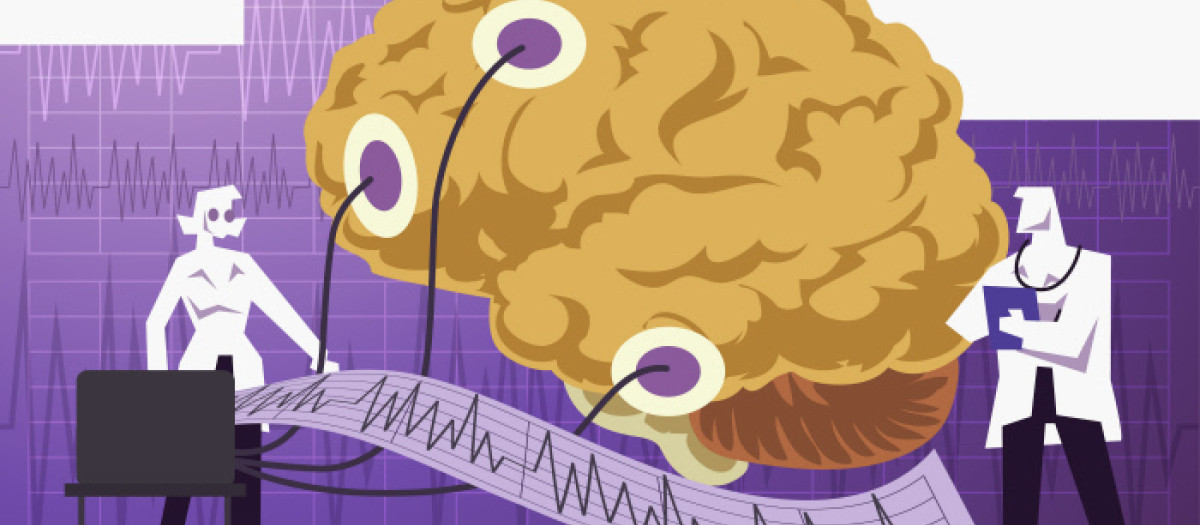 Recomendaciones para tratar la Epilepsia en adultos mayores.
